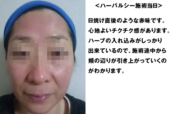 56歳副店長のお肌日記 〜 ハーバルシーでお肌が生まれかわりました